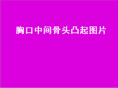 胸口中间骨头凸起图片（胸口中间骨头凸起图片这个怎么办）